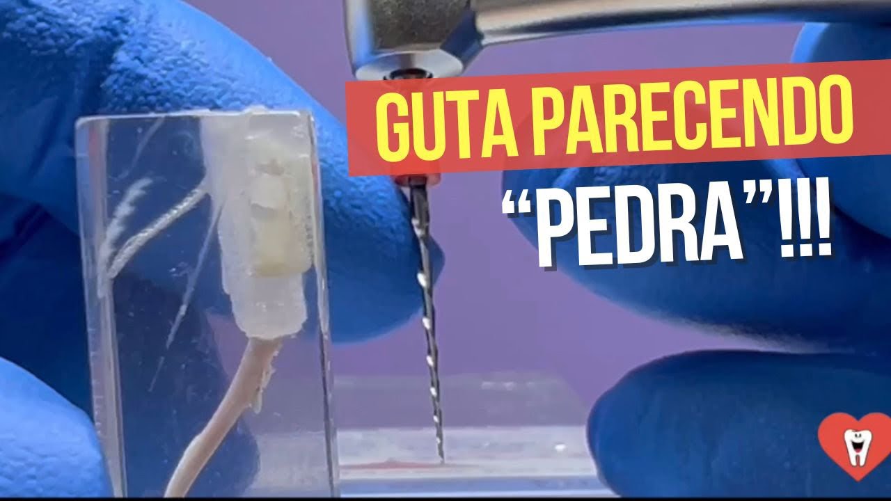 O QUE FAZER QUANDO A LIMA NEM ENTRA NO COMEÇO DA GUTA?