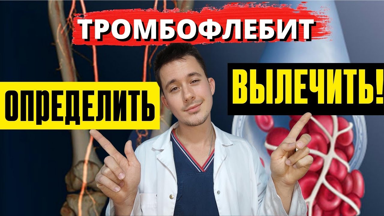Тромбофлебит глубоких и поверхностных вен | Симптомы Лечение