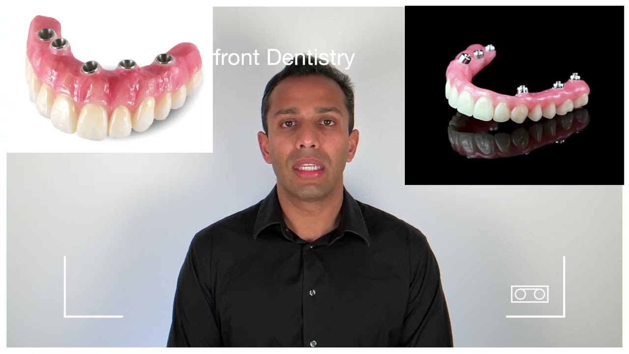 More options to treat missing teeth: