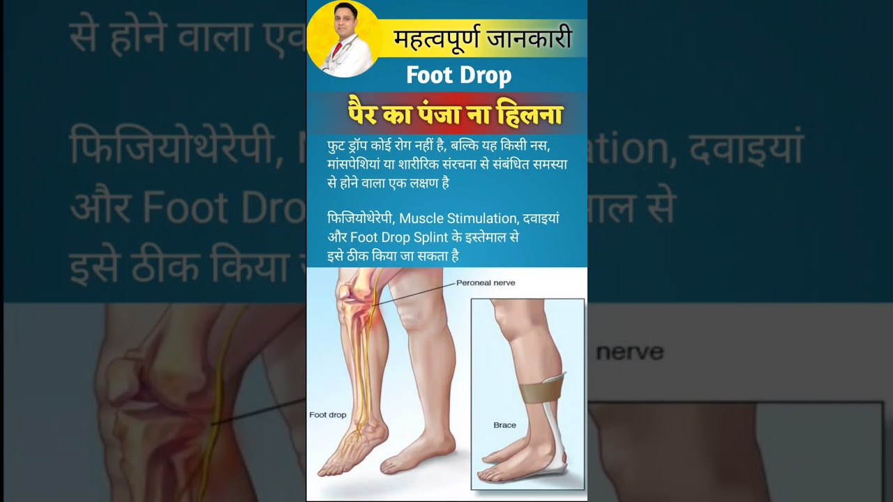 Foot Drop kaise theek Karen #shorts #physiodrdeepaksoni