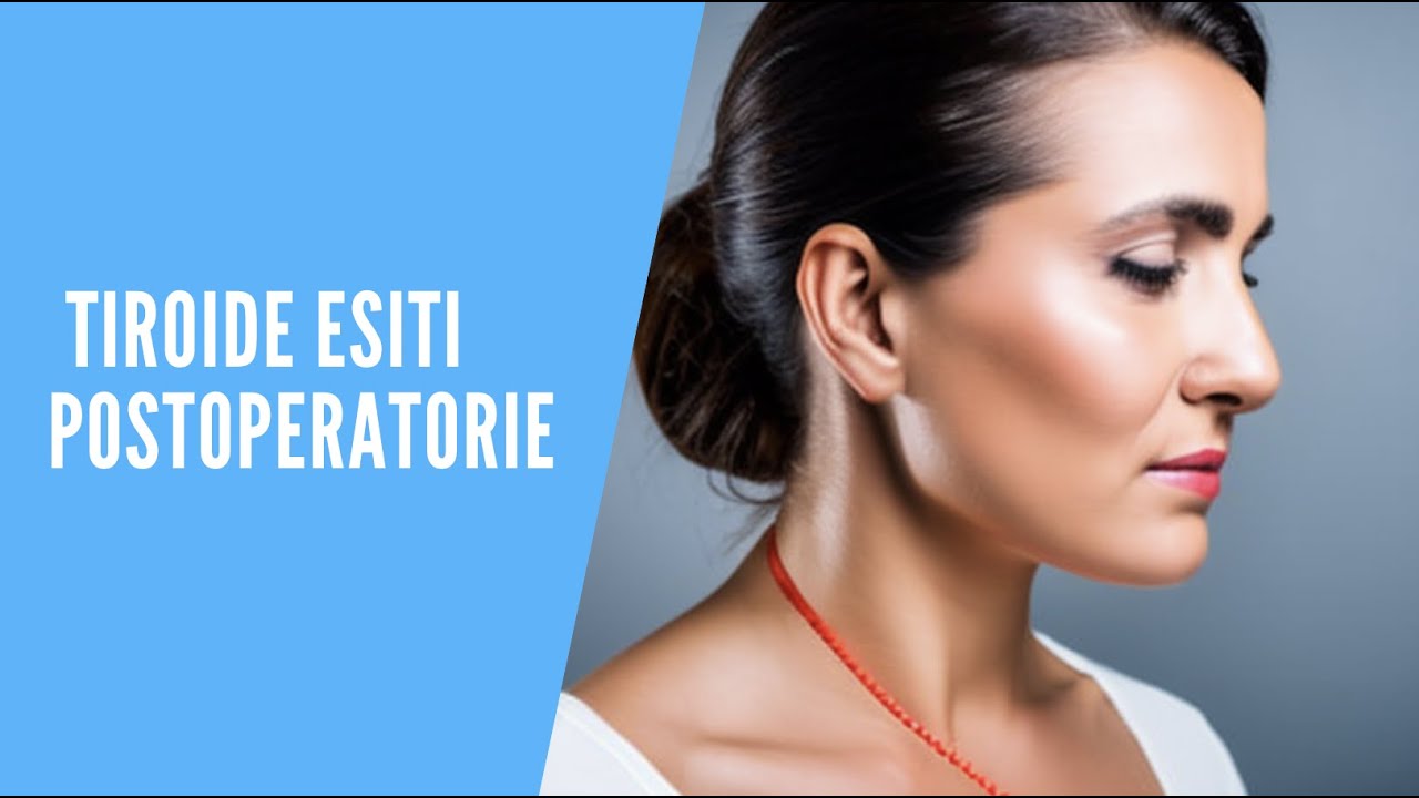 Tiroide: recupero post-chirurgico