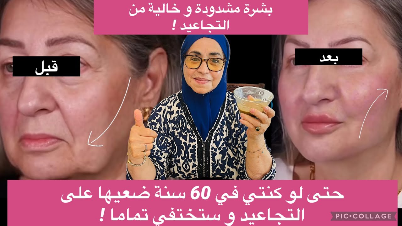 تحدي حقيقي: ماسك طبيعي يشد البشرة ويزيل التجاعيد نهائيًا حتى فـ60 سنة وما فوق