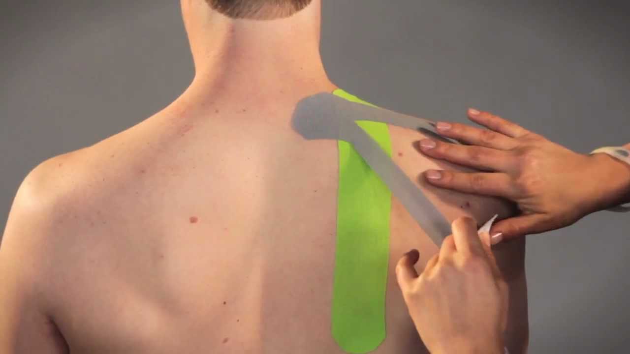 PerformTex Tape.  How To Tape for Shoulder Support 2