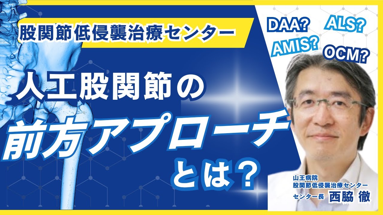 人工股関節の前方アプローチとは？