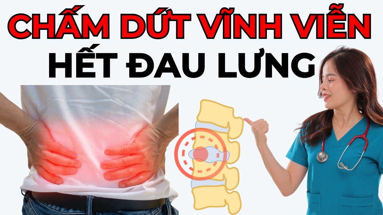 Chỉ Cần Làm 1 Điều, Thoát Vị Đĩa Đệm Biến Mất Hoàn Toàn! | Dr Thùy Dung