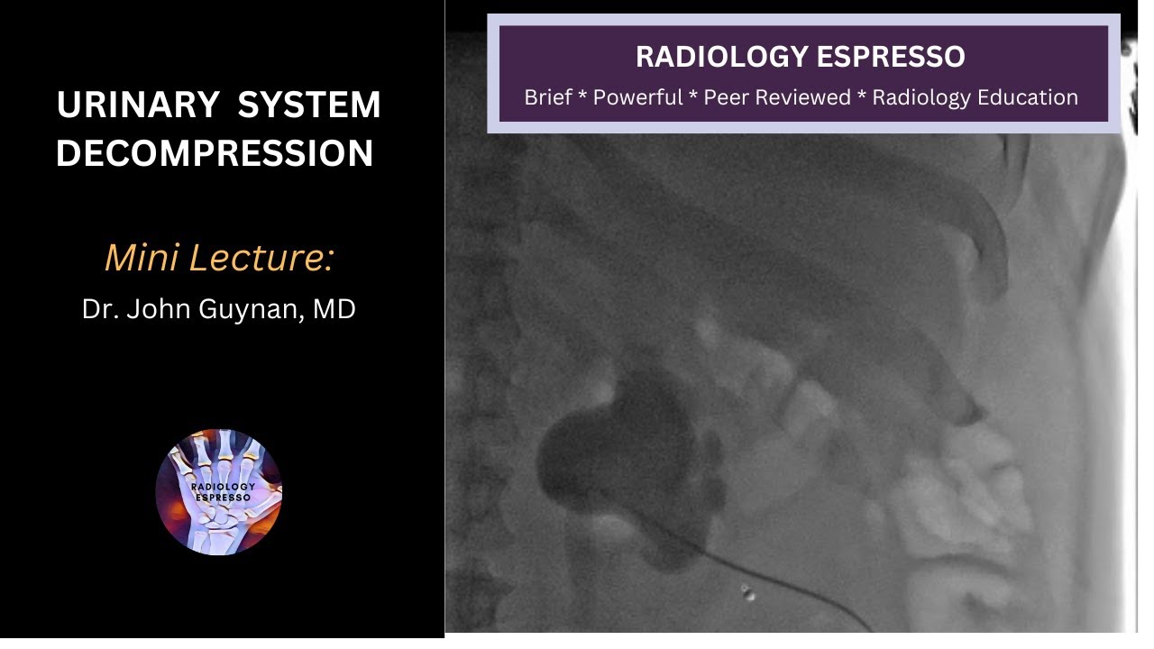 URINARY SYSTEM DECOMPRESSION - PERCUTANEOUS NEPHROSTOMY TUBE: Mini Lecture, Dr. John Guynan, MD
