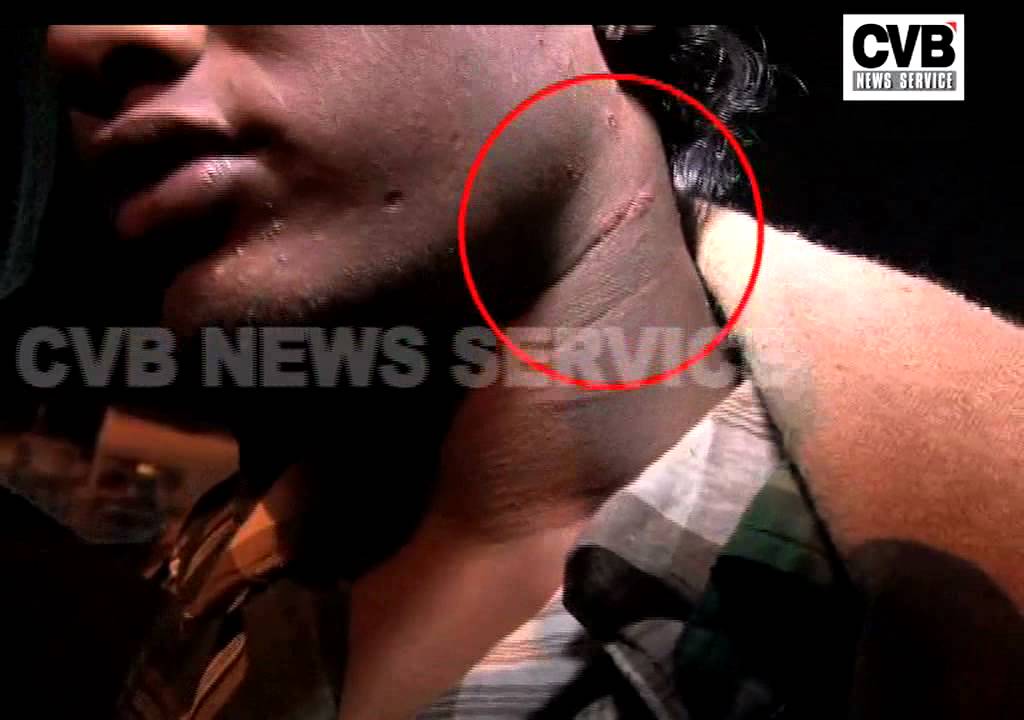 TEMPLE AUTHORITIES ALLEGEDLY ASSAULT DEVOTEES IN BENGALURU TEMPLE