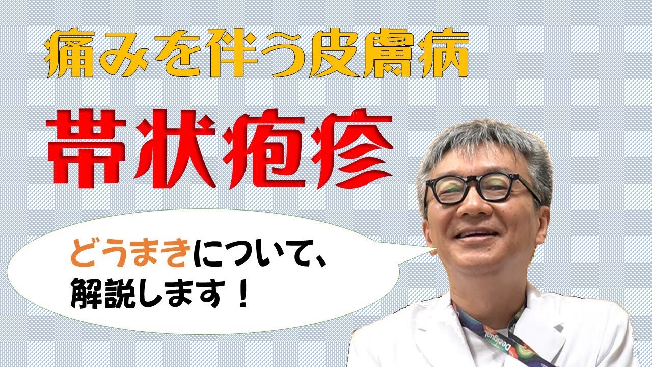 痛みを伴う皮膚病（帯状疱疹）について　島根県立中央病院　知って得する健康ミニ知識＃１２