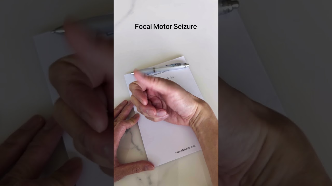 Focal Motor Seizure Vs Myoclonic Seizure