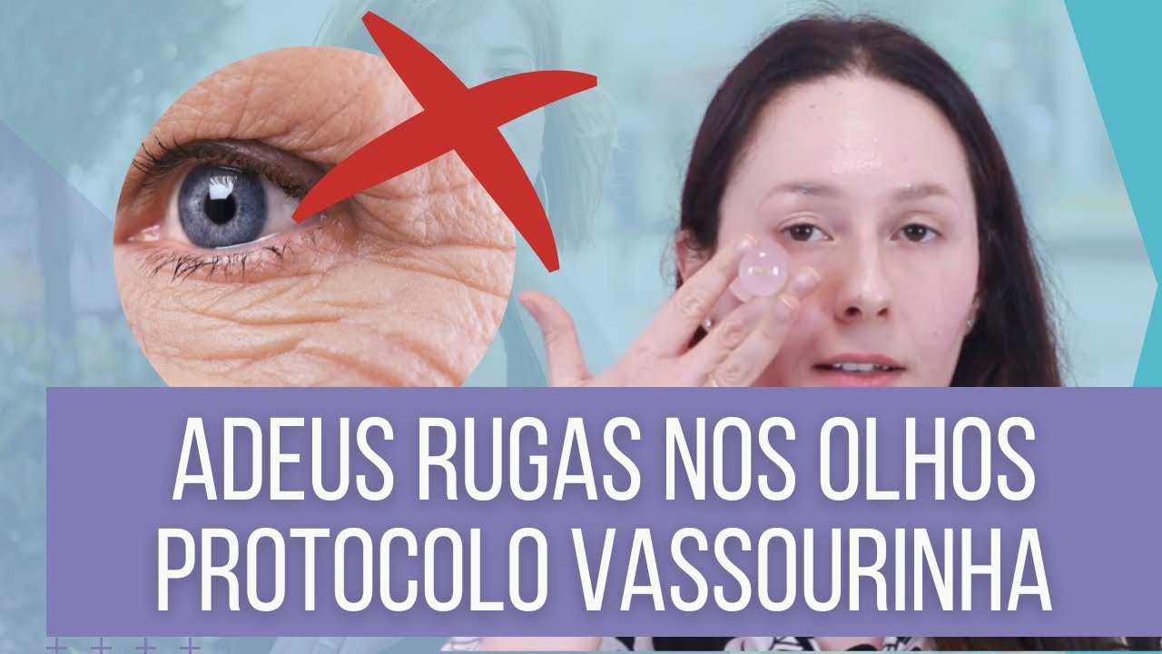 Protocolo VASSOURINHA para rugas nos olhos