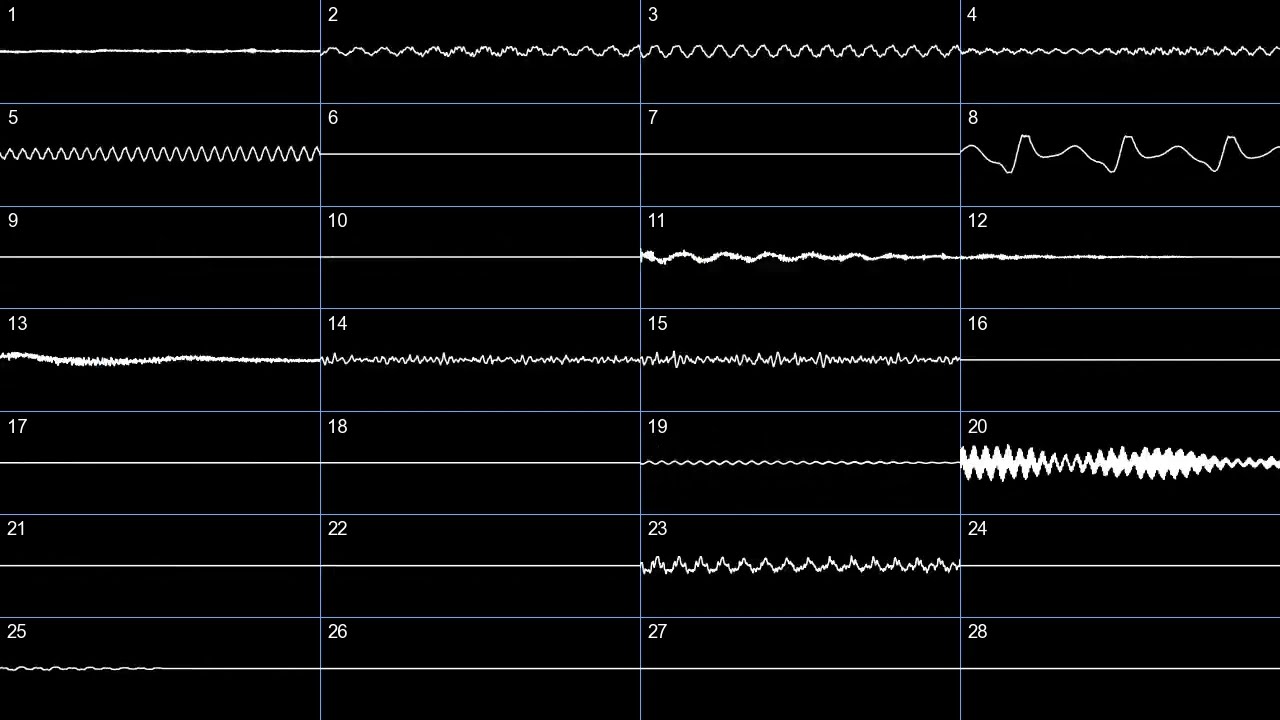 kleeder - Beats to Stream and Donate to (oscilloscope)