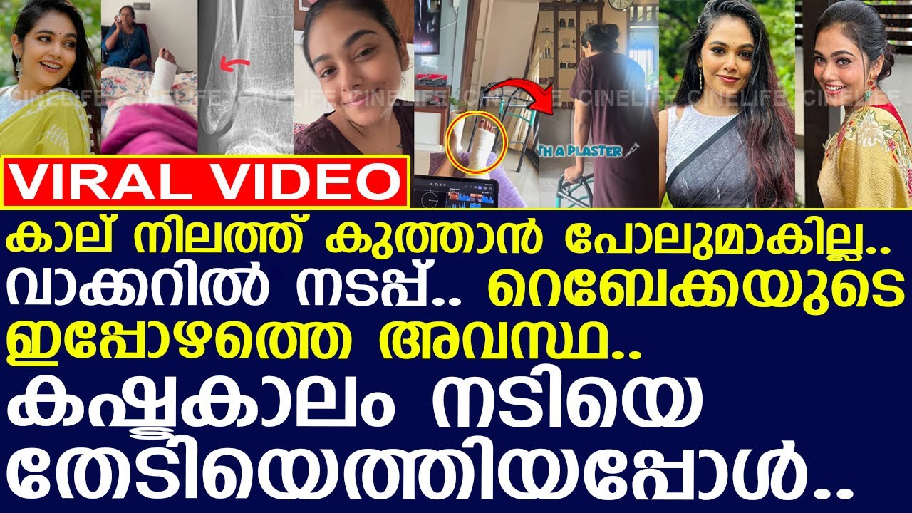 കാലിന് പ്ലാസ്റ്ററിട്ടിരിക്കുന്ന റെബേക്കയുടെ ഇപ്പോഴത്തെ അവസ്ഥ..!! l Rebecca Santhosh