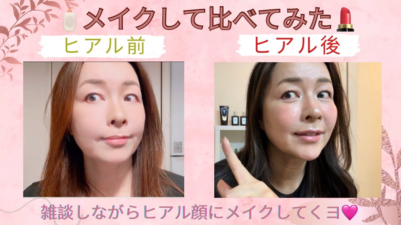 【50代・雑談しながらメイク💕】ヒアルロン酸注入した顔にメイクしてヒアル前と比べてみた｜カスタマイズヒアル