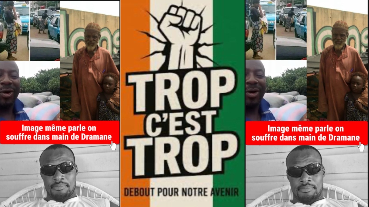 l image même parle d elle même ont souffrent dans la main de Dramane  #humor