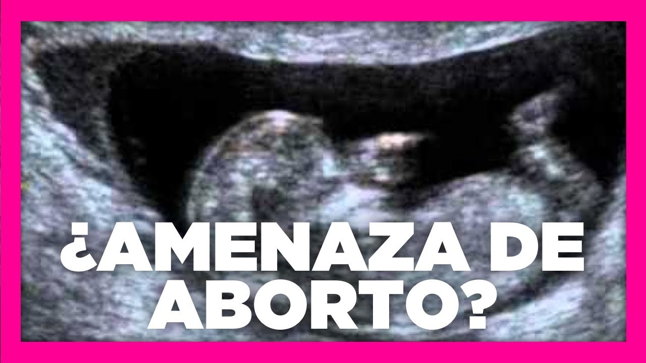 ¿Qué son los hematomas retrocoriales? | Dra Katy Villa