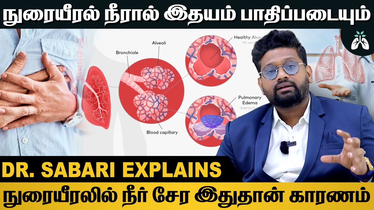 நுரையீரலில்  நீர் கோர்ப்பதை தடுக்க இதை செய்தால் போதும் | Dr Sabarinath Explains #pulmonaryedema