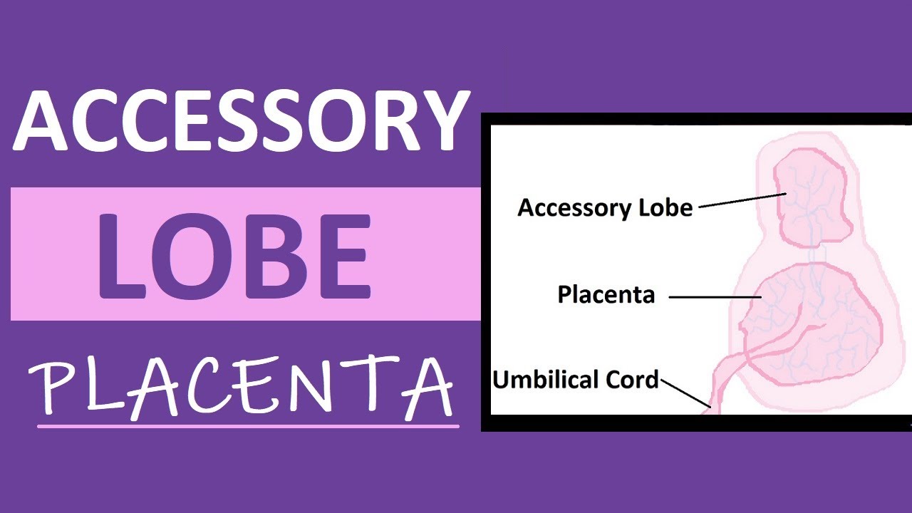 Accessory Lobe Placenta | Succenturiate Placenta Experience | Pregnancy Vlog