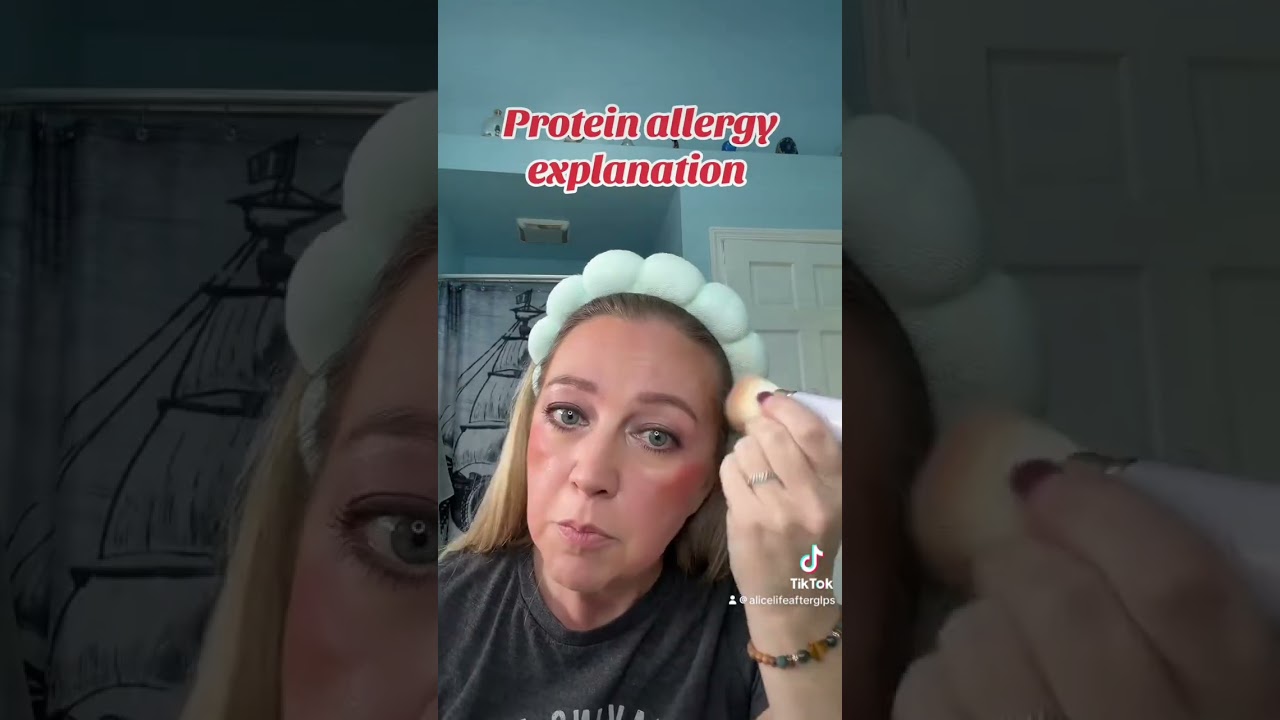 Allergies are not fun and especially when you have an extreme reaction.   #allergies #coffee 