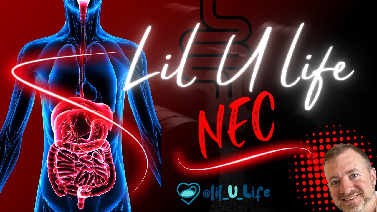 What is Necrotizing Enterocolitis?