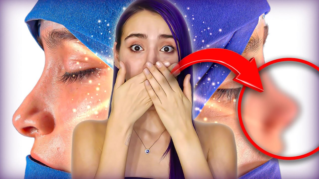 ASÍ QUEDÓ MI NARIZ después de la CIRUGÍA 👃🏻😳