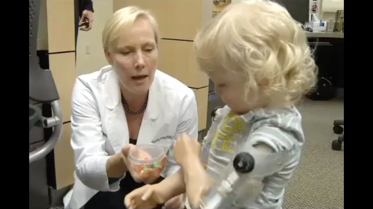 Toddler With Short Arms Gets Electric Hands