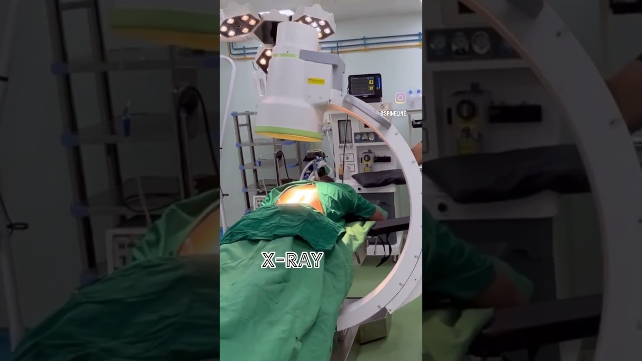 Use of X-ray machine during spine surgery!