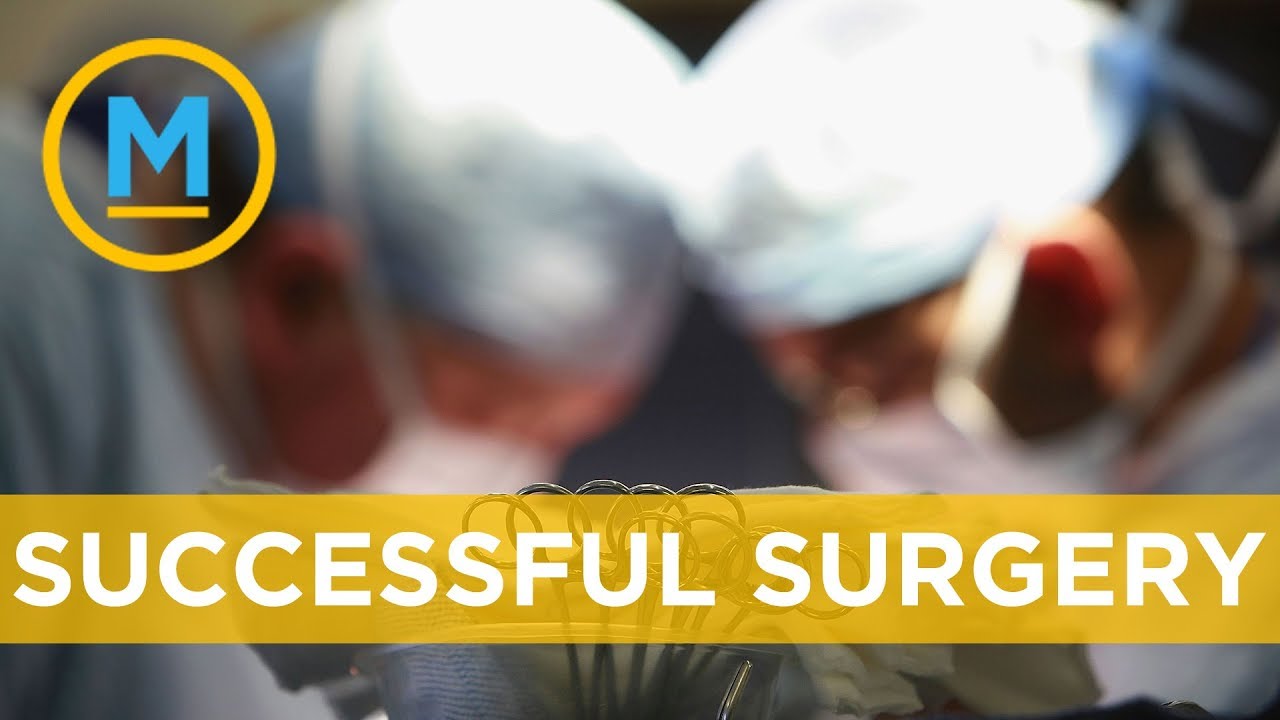 World's first surgical procedure for 'nutcracker syndrome' was very successful