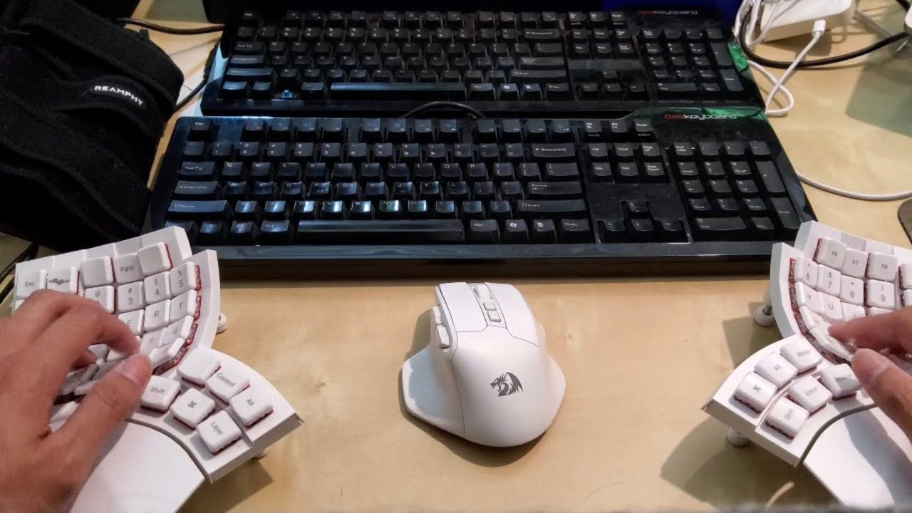 Glove80 Typing Test, Sound Comparison, and Cubital Tunnel Syndrome Conclusion