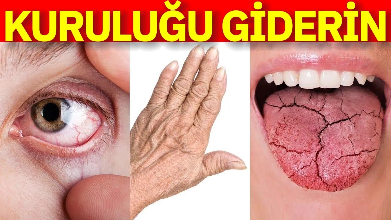 Kuru Cilt, Göz ve Ağız İçin En Etkili Çözümler | Dr. Berg Türkçe