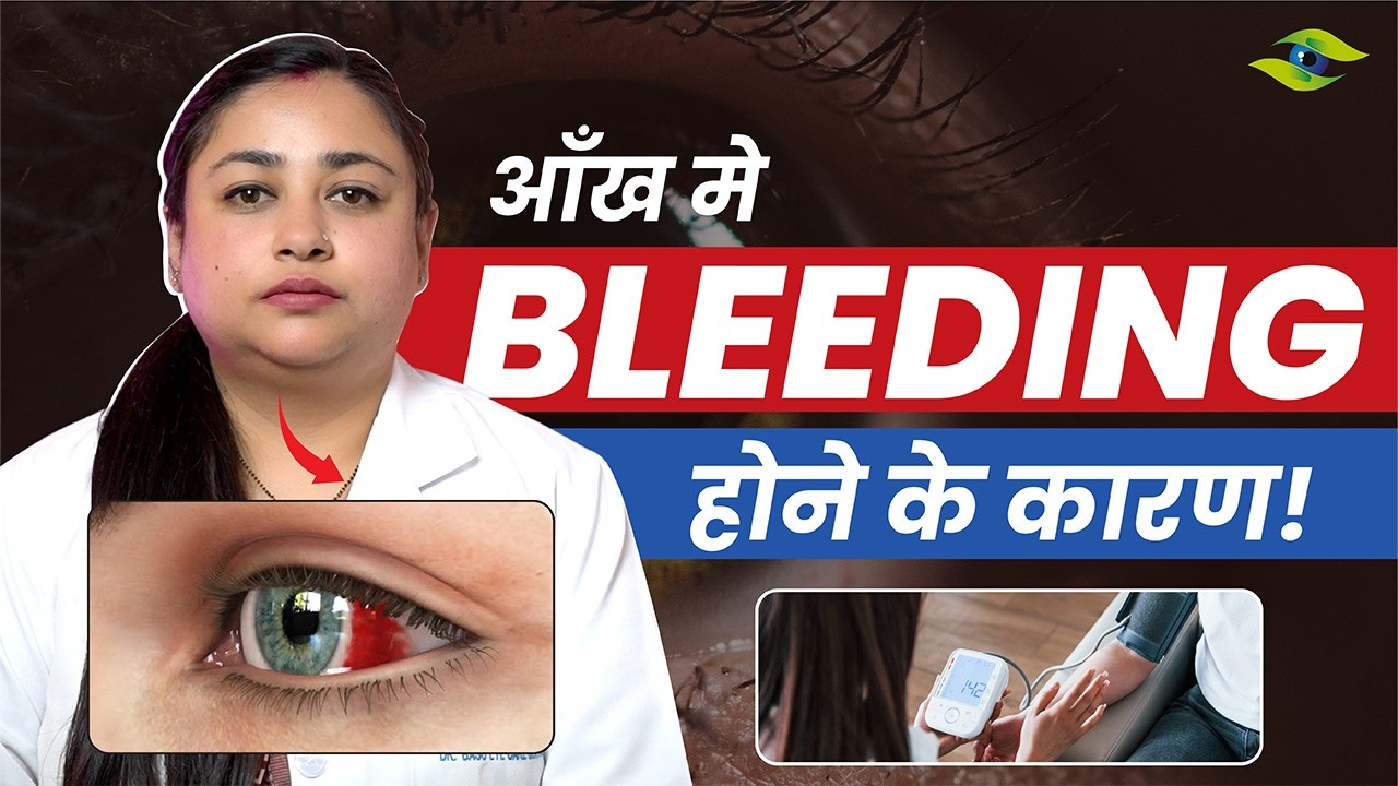 Bleeding in the Eye? Causes, Care & When to See a Doctor | Dr. Basu Eye Care Centre