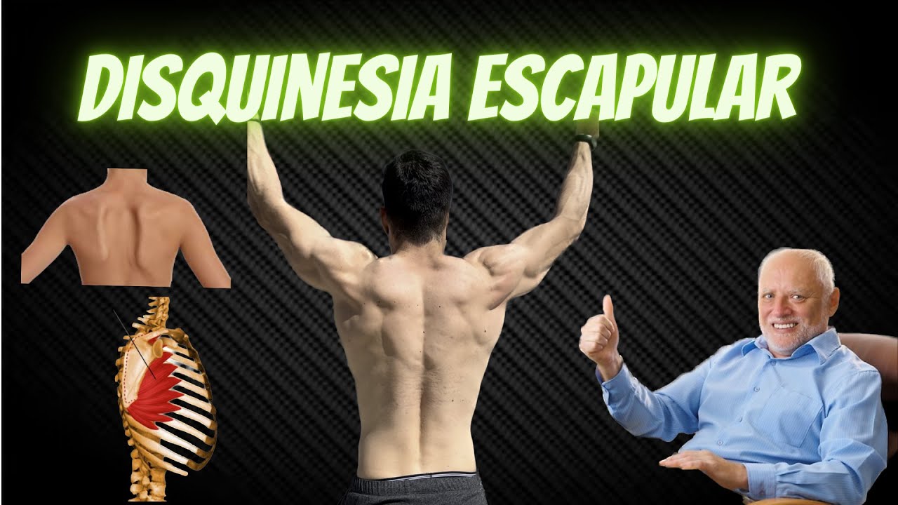 🙌🏽🫨C&Oacute;MO RECOLOCAR TUS ESC&Aacute;PULAS😳🙌🏽-Disquinesia Escapular (esc&aacute;pulas aladas)