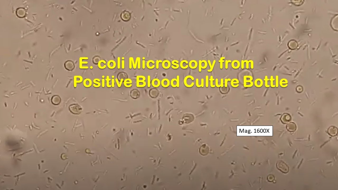 E. coli in Wet Mount of Tryptone soy broth