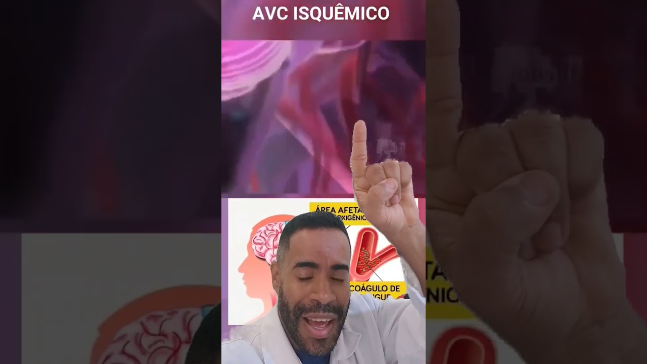 Como ocorre o AVC isqu&ecirc;mico #medicina #enfermagem