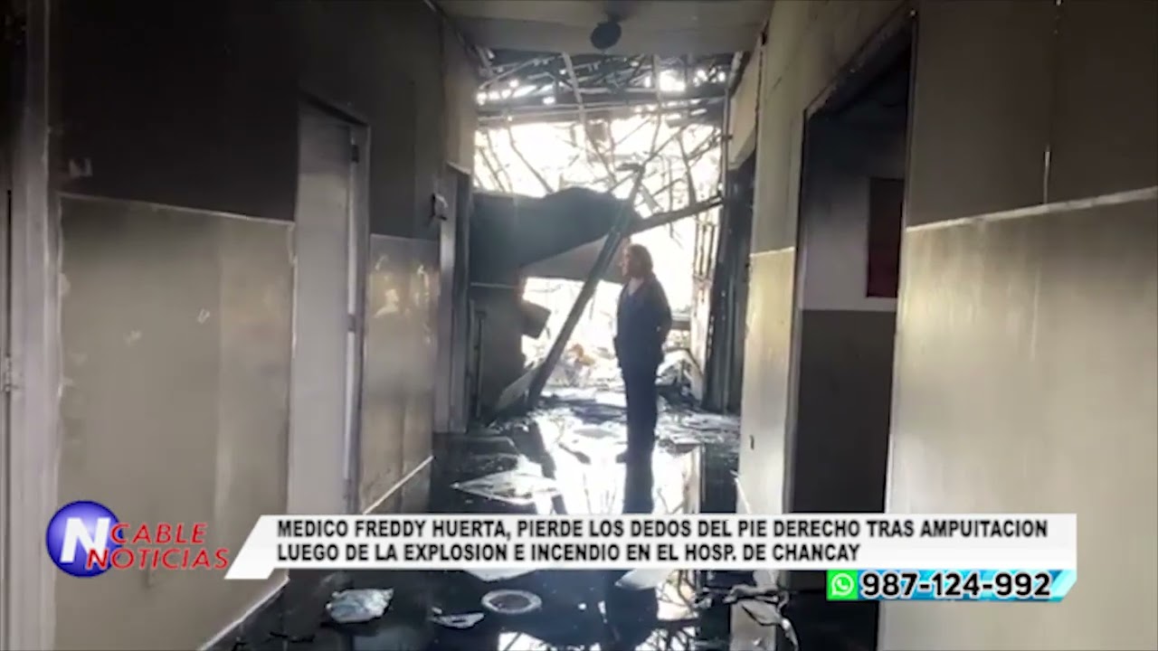 MEDICO FREDDY HUERTA, PIERDE LOS DEDOS DEL PIE DERECHO LUEGO DE LA EXPLOSION EN EL HOSP. DE CHANCAY