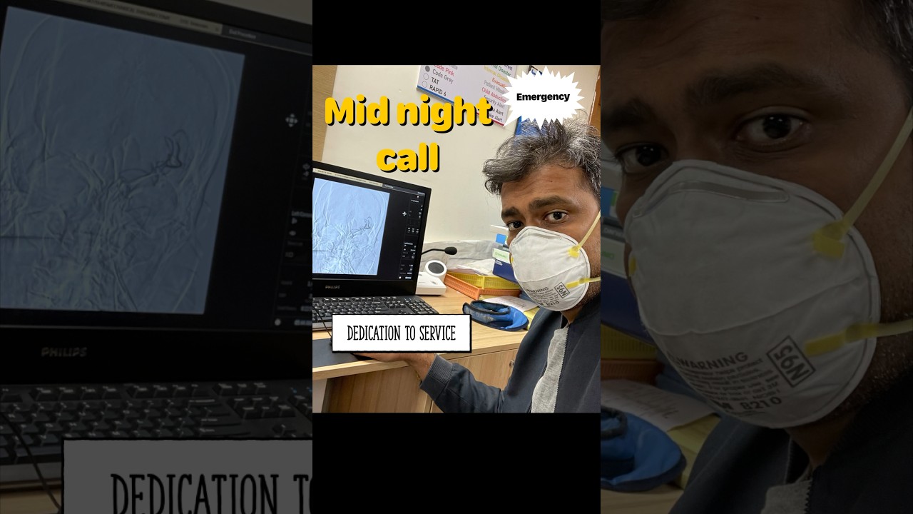 Mechanical Thrombectomy/ Stroke treatment / Dr Dharav Neurointervention in Mumbai