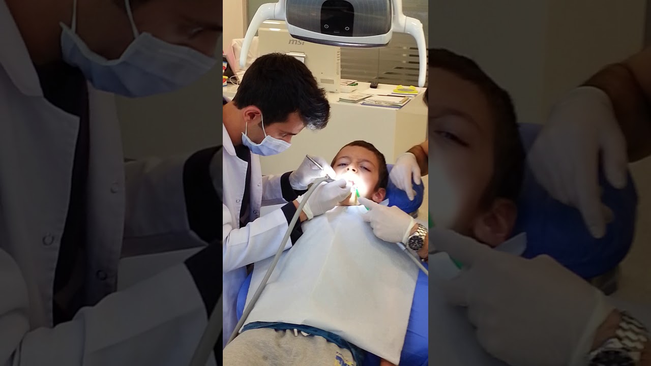 Kanal tedavisi diş çocuk çocuklar için yeni