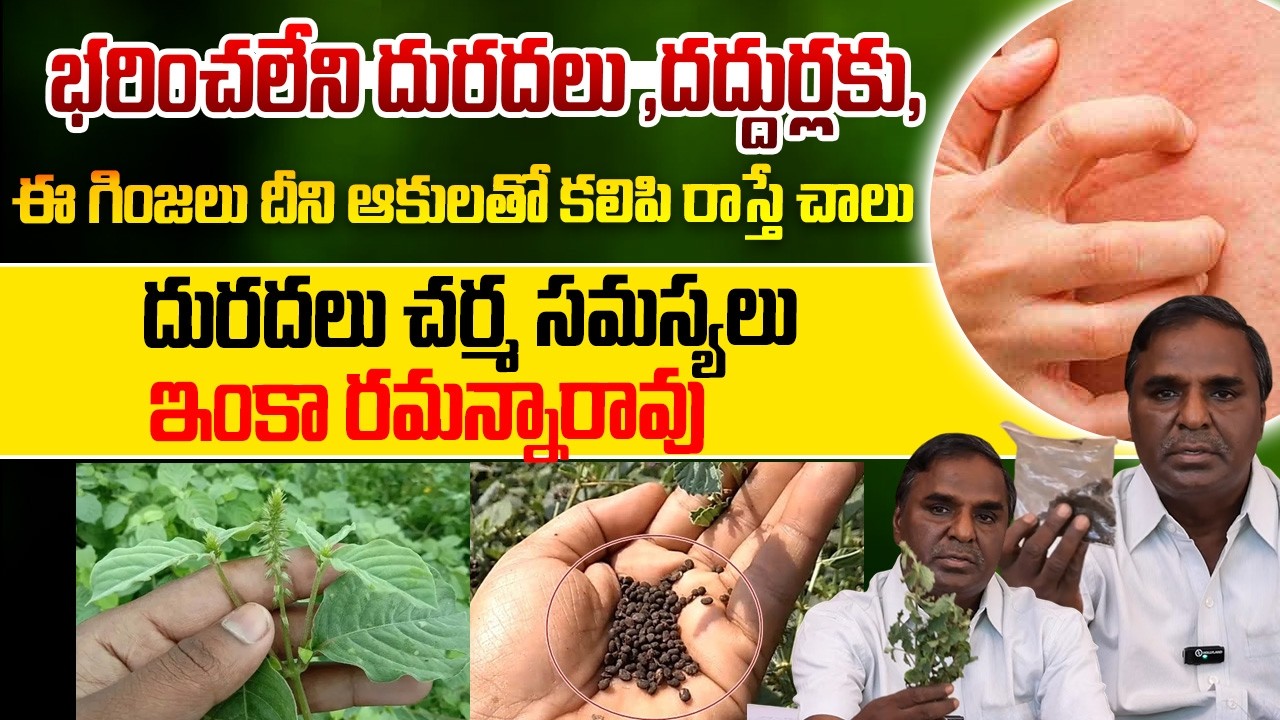 ఈ గింజలతో దురదలు, చర్మ సమస్యలు ఇంకా రమన్నారావు | Natural Remedies for Skin Allergy & Itching
