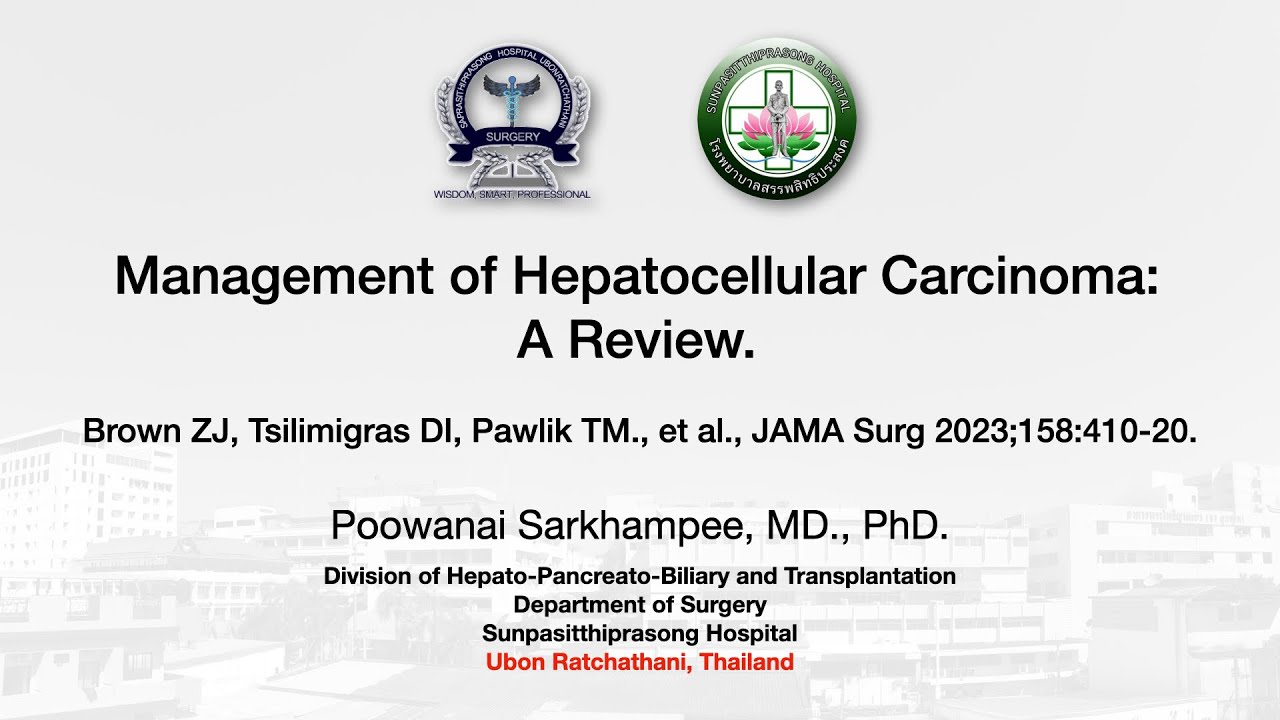 EP11 Management of HCC: A review (Brown ZJ, Pawlik TM., et al., JAMA Surg 2023;158:410-20.)