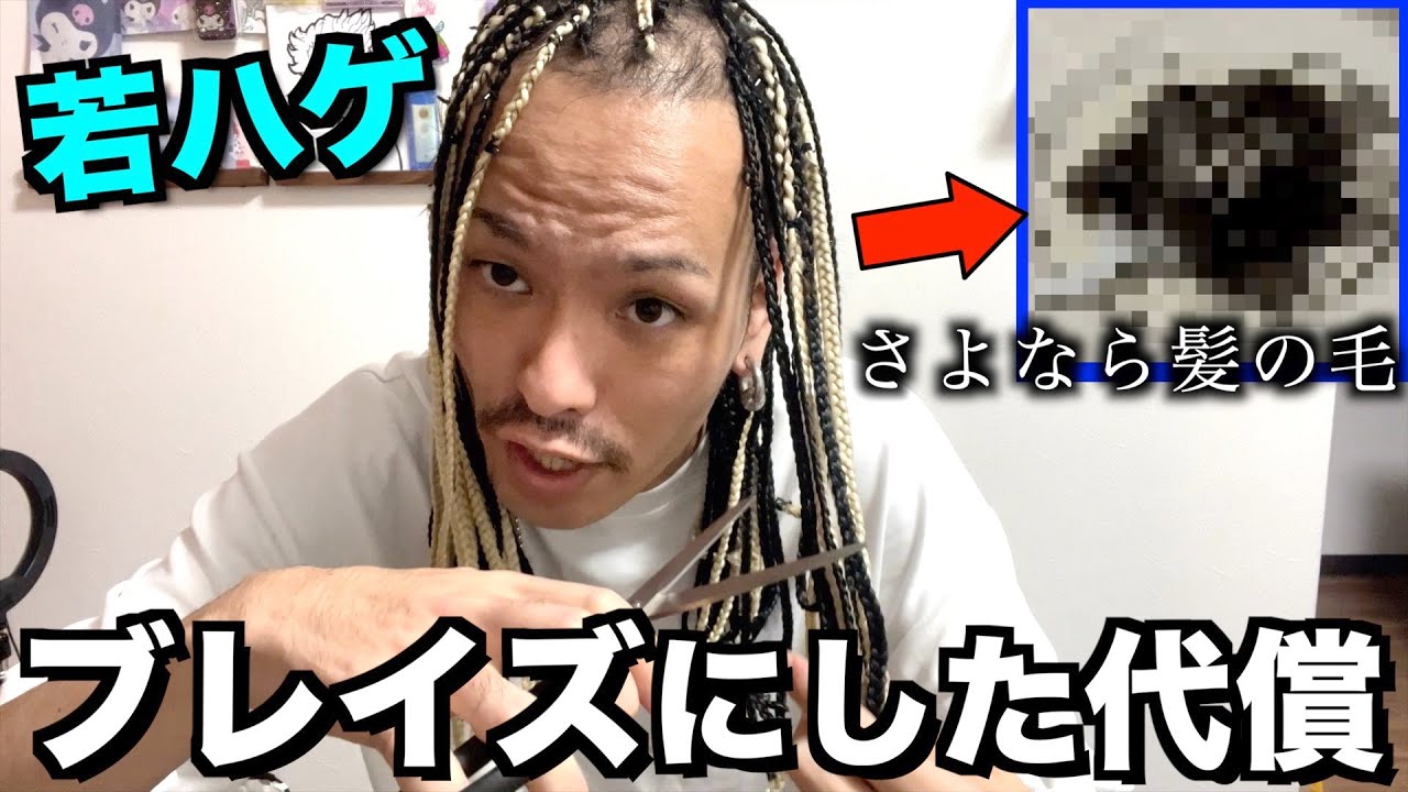 【髪の毛】若ハゲが編み込みブレイズを切った結果が衝撃過ぎた