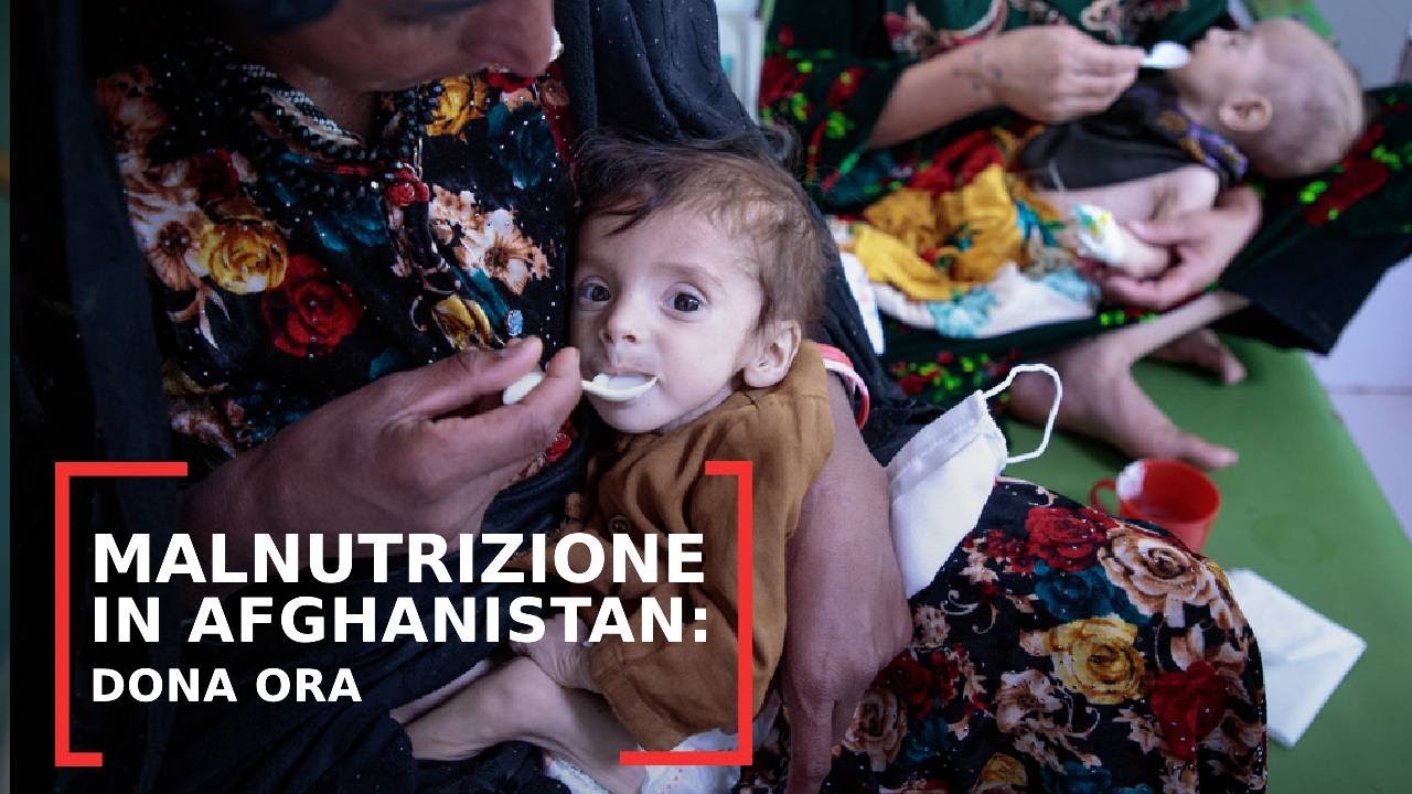 Malnutrizione in Afghanistan: dona ora e salva le vite dei bambini gravemente malnutriti