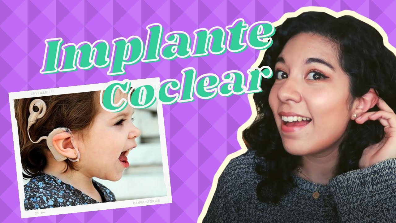 TODO LO QUE TIENES QUE SABER SOBRE EL IMPLANTE COCLEAR 👂🏻