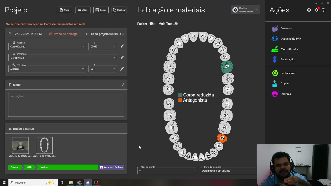 Exocad Facilitado Segredos e Técnicas (Curso Hotmart)