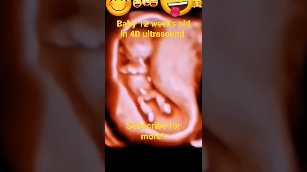 Baby in ultrasound 4D, baby is fighting in mother's womb, #ultrasound4d. Subscribe for more!