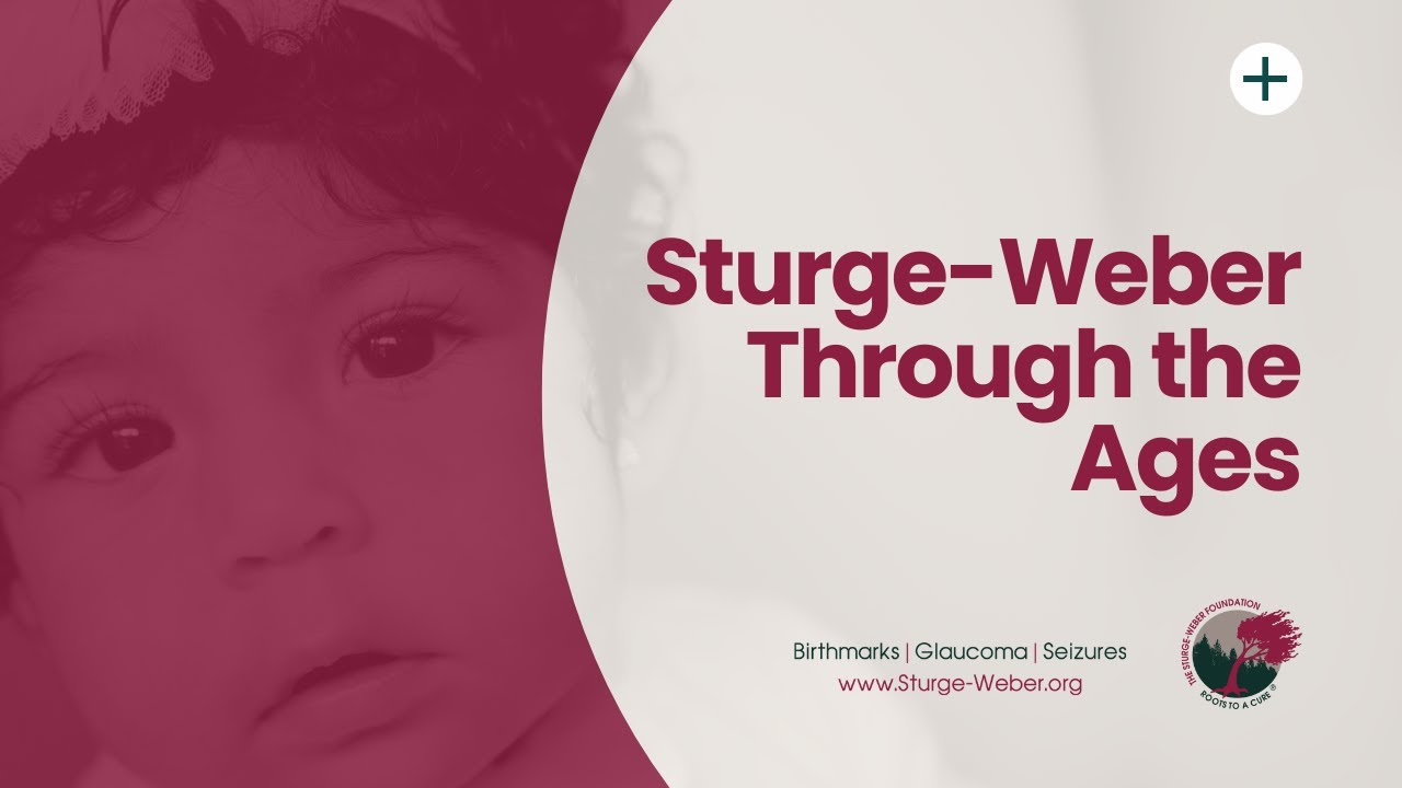 Sturge-Weber Through the Ages