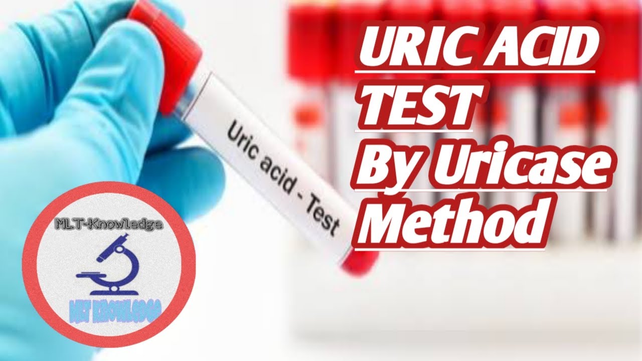 uric acid test| uric acid test procedure | uric acid estimation by uricase method