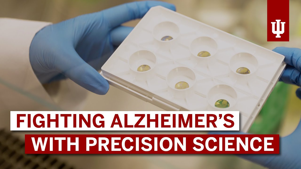 Pushing new boundaries in Alzheimer's research with cutting edge biosciences