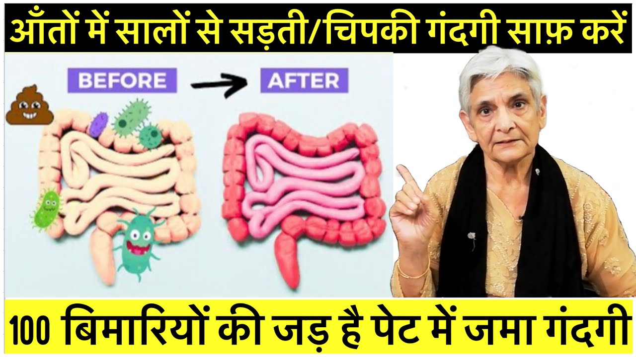 आँतों से चिपका मल निकालने का आसान तरीका 100 बिमारियों की जड़ है पेट में जमा गंदगी,Detox your colon
