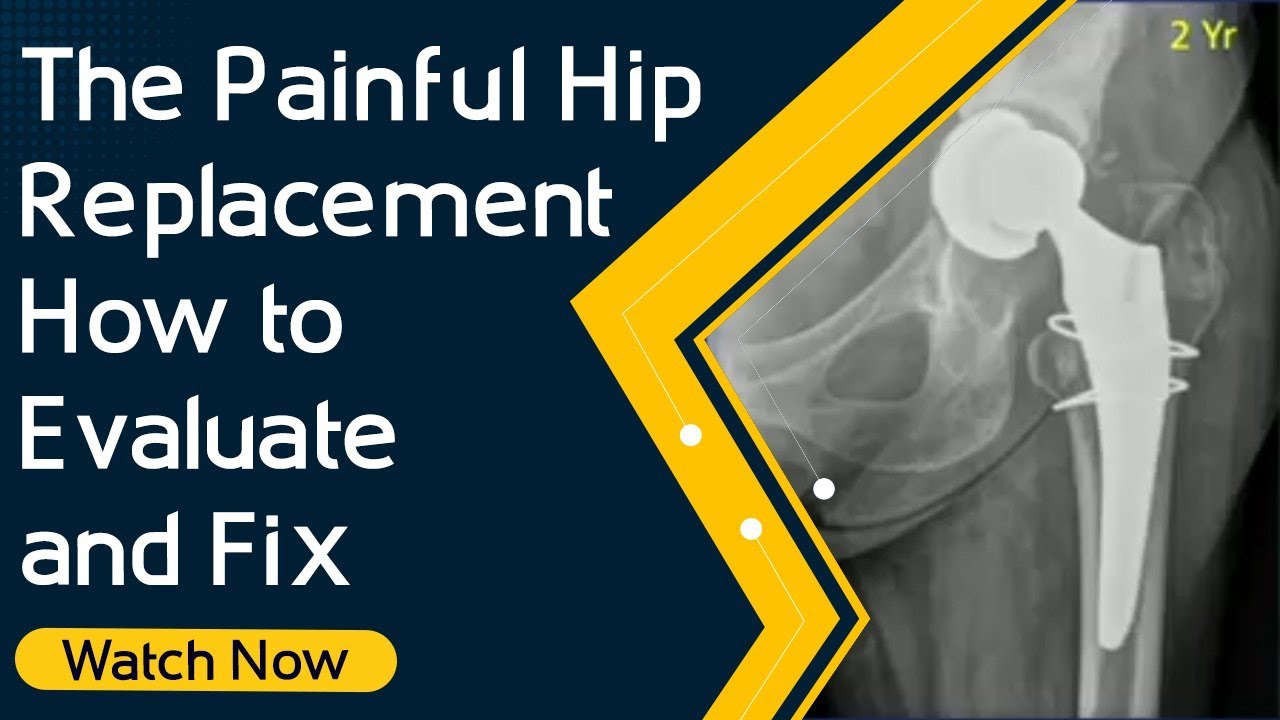 The Painful Hip Replacement - How to Evaluate and Fix | Orthopaedic Academy