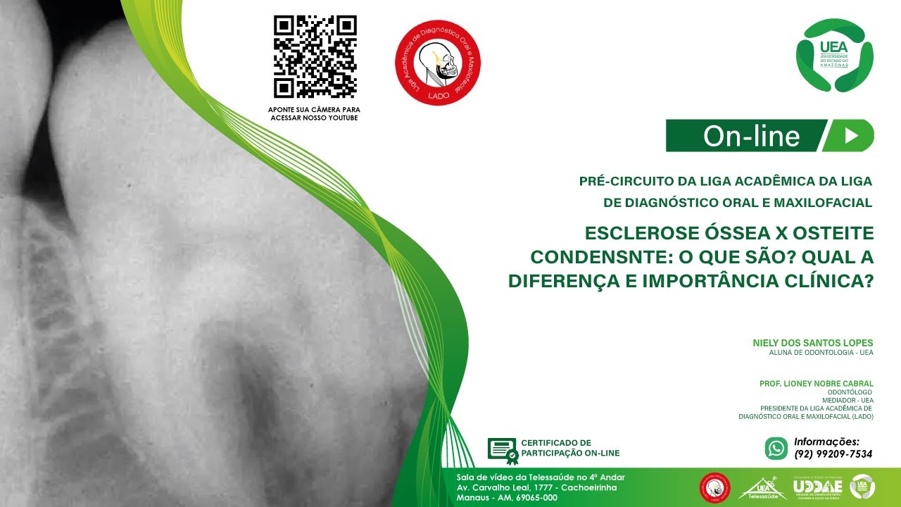 LADO - Esclerose óssea X Osteite condensnte: O que são? Qual a diferença e importância clínica?