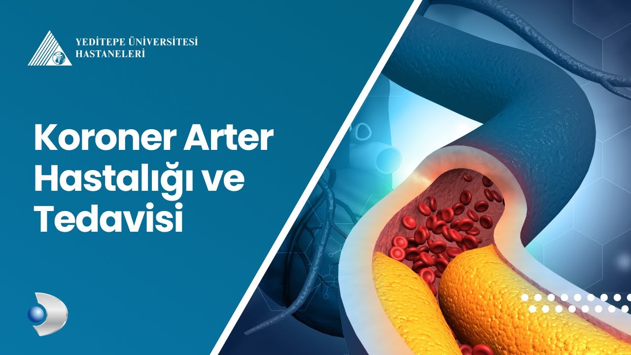 Koroner Arter Hastalığı ve Tedavisi | Prof. Dr. Olcay Özveren